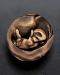 3D Art From Your Ultrasound
