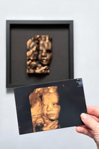 3D Art From Your Ultrasound