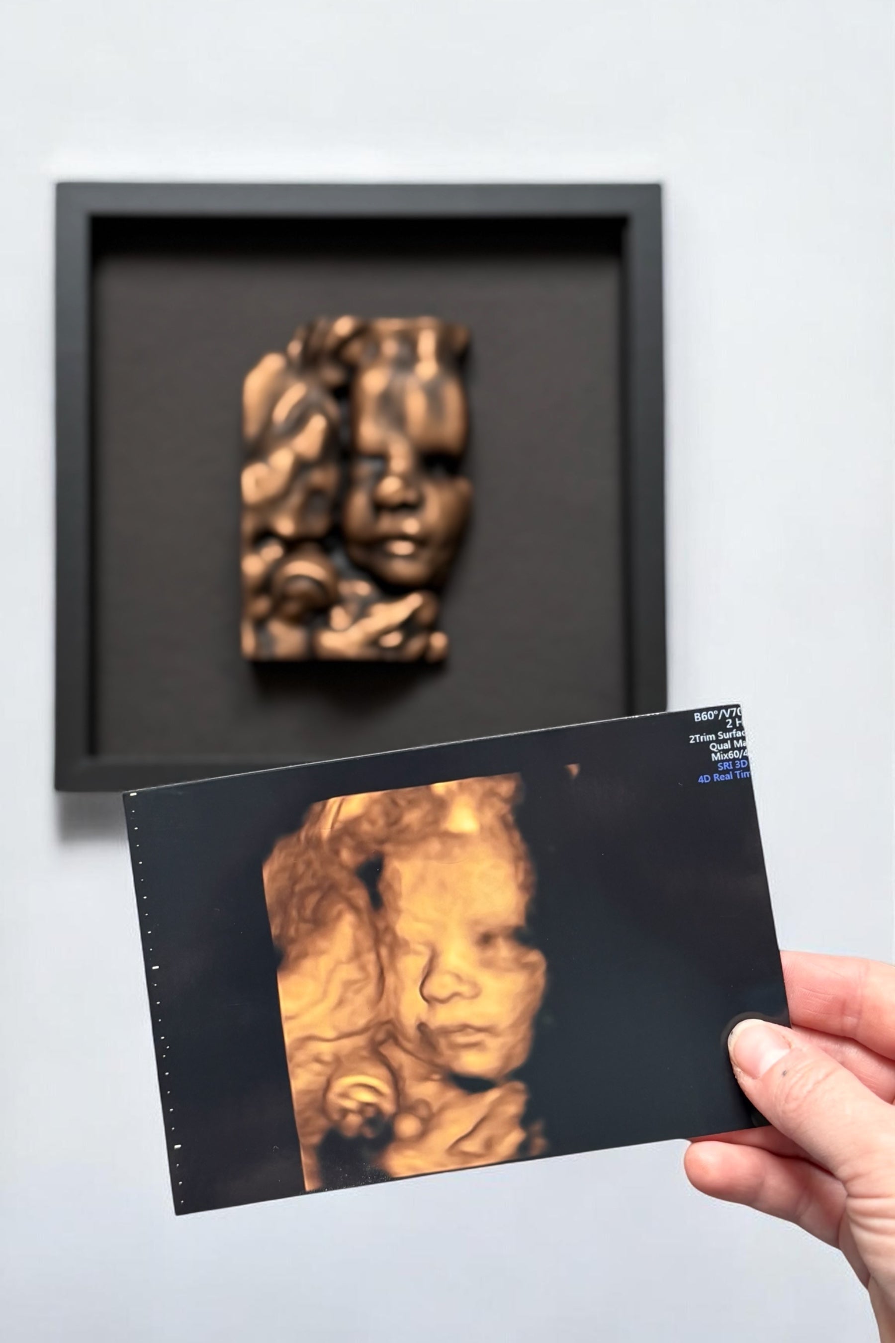 3D Art From Your Ultrasound