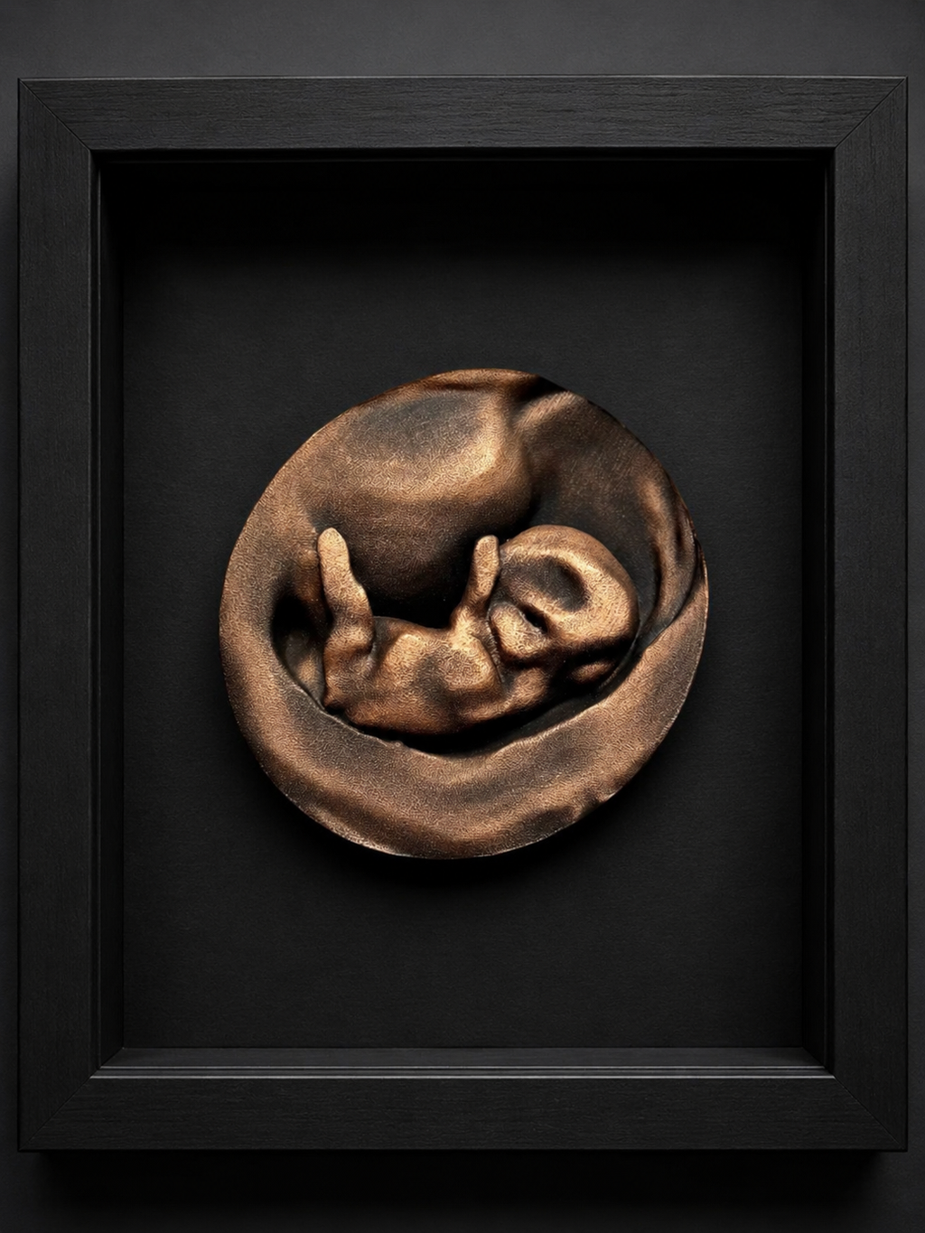 3D Sculpture From Your Ultrasound