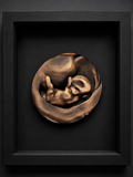 3D Sculpture From Your Ultrasound