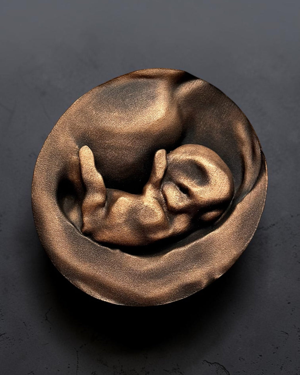 3D Sculpture From Your Ultrasound